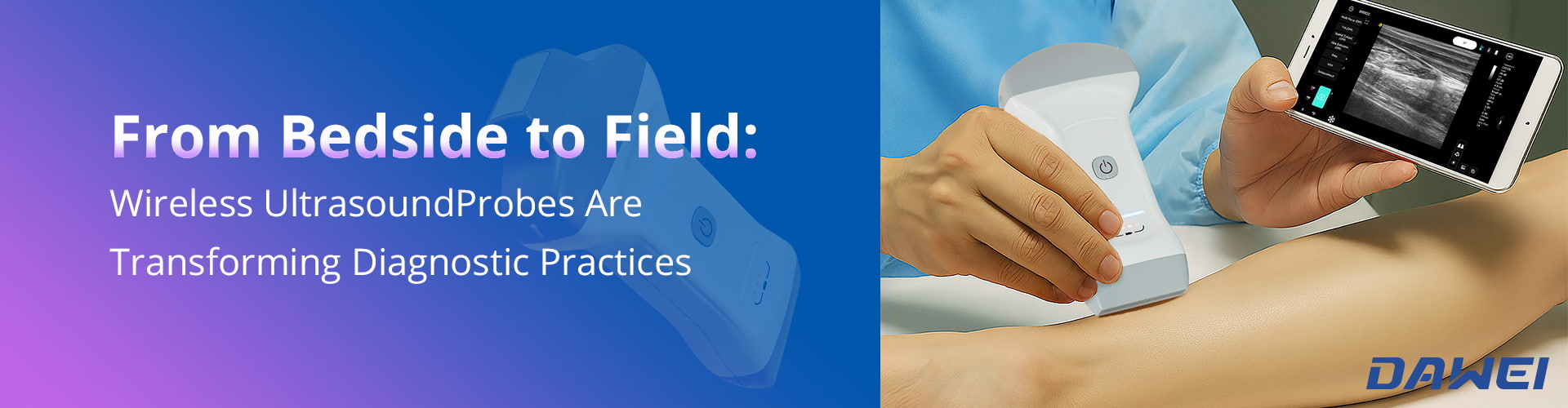From Bedside To Field How Wireless Ultrasound Probes Are Transforming Diagnostic Practices От постели до поля Как беспроводные ультразвуковые датчики меняют диагностическую практику