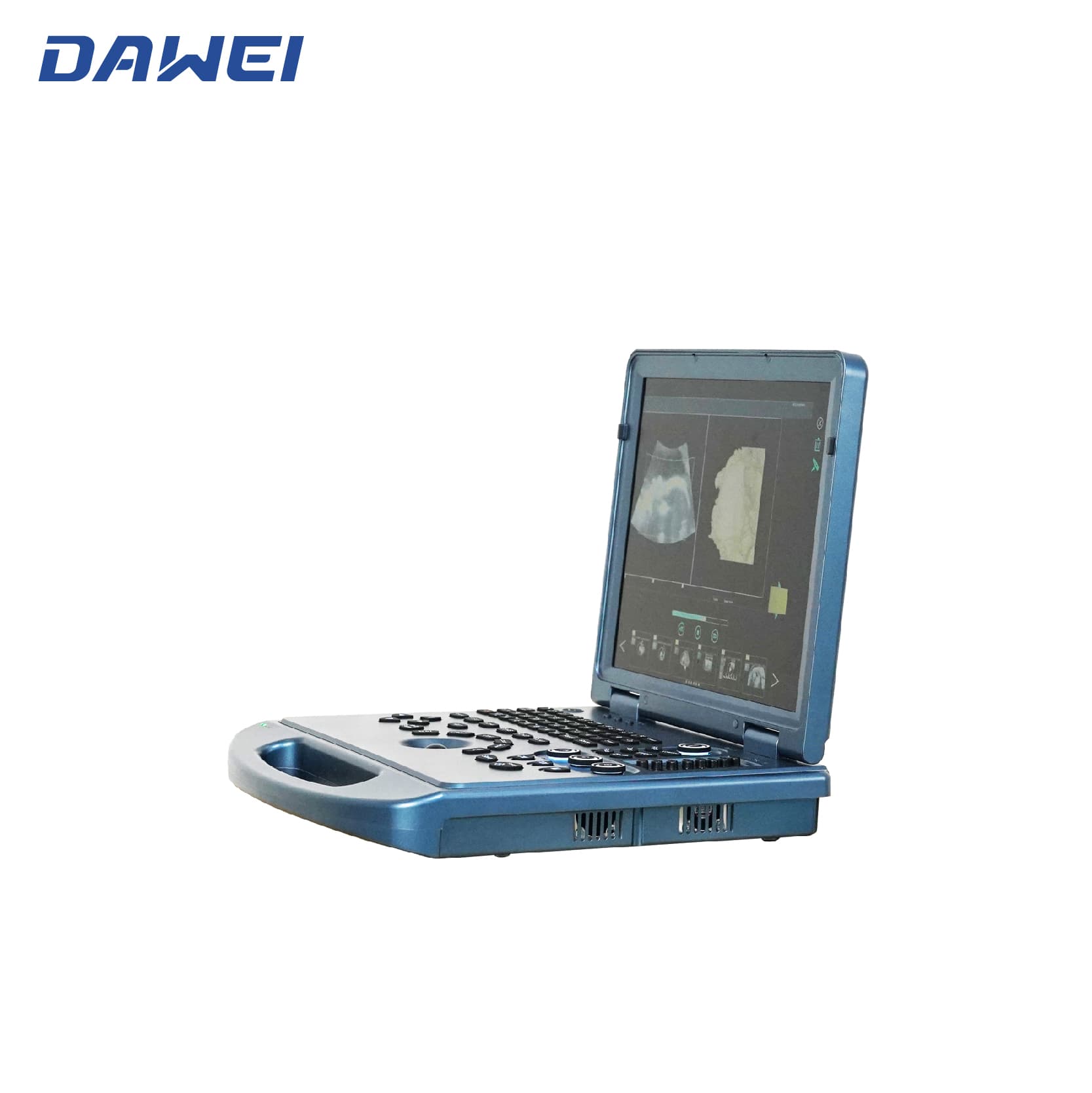 Доступная ультразвуковая система 4D ноутбука