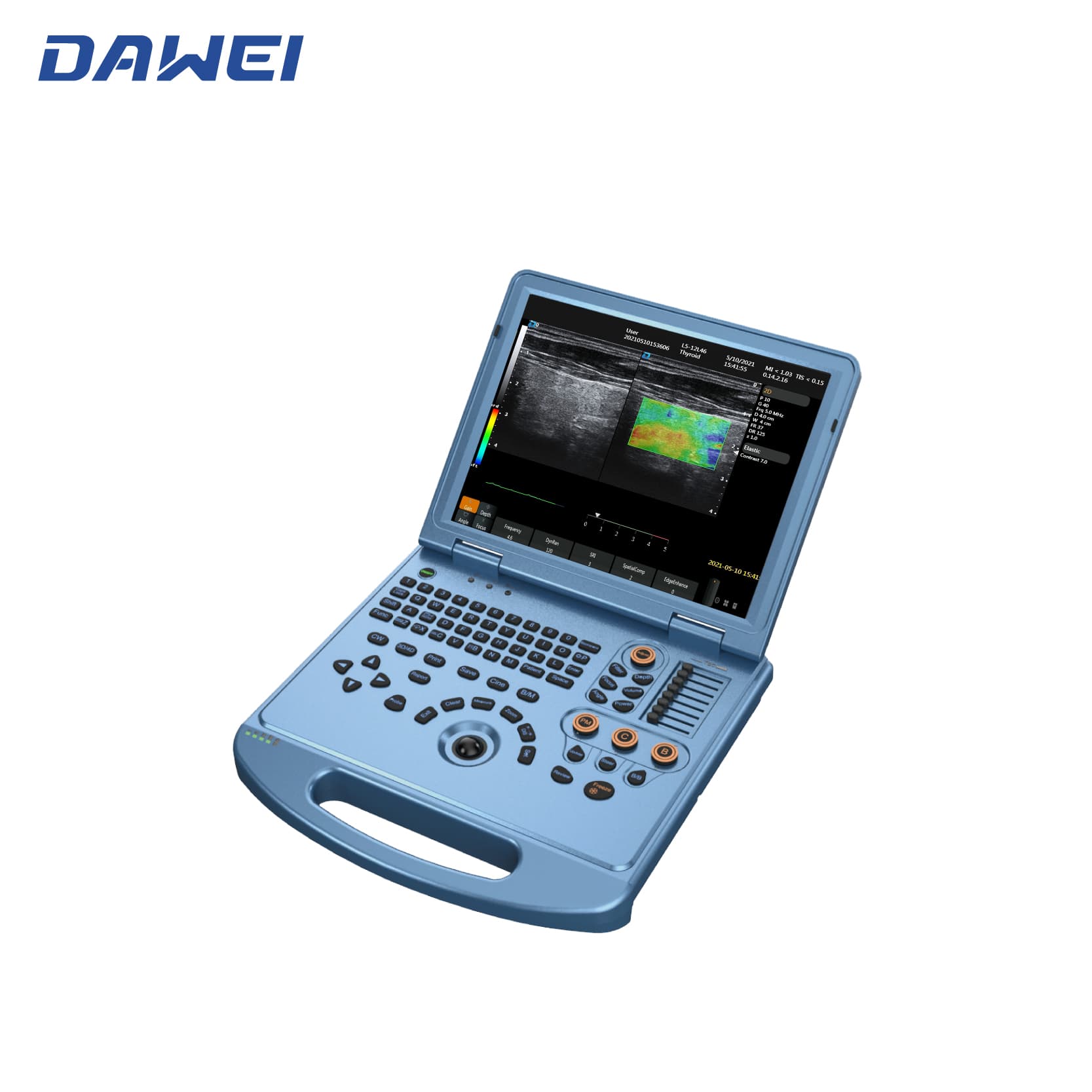 Доступная ультразвуковая система 4D ноутбука