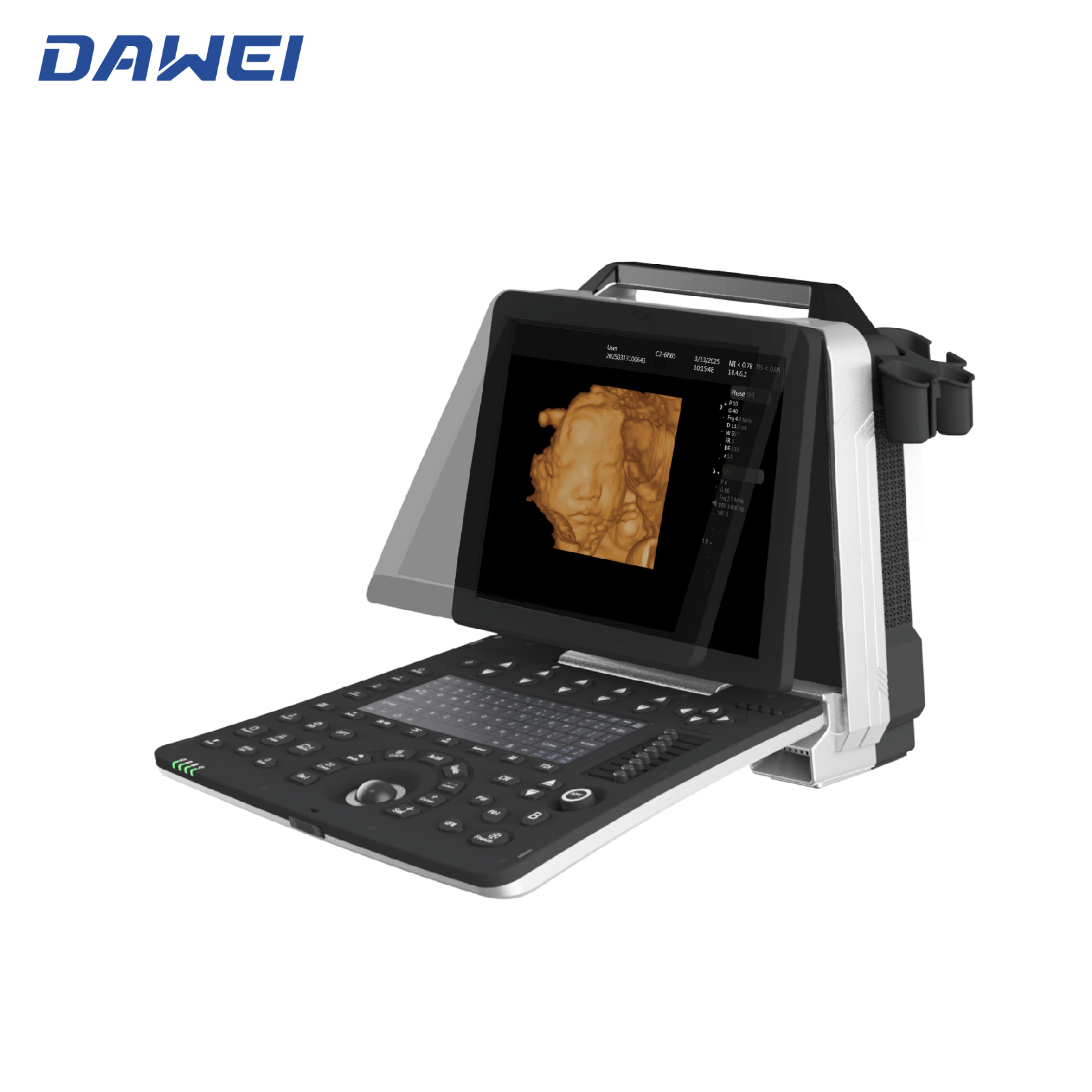 Дешевый портативный ультразвуковой аппарат 3D 4D