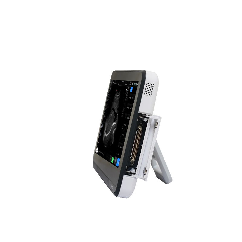 Портативный ультразвуковой аппарат с сенсорным экраном