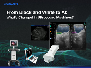 From Black and White to AI What’s Changed in Ultrasound Machines 800 600_画板 1.jpg