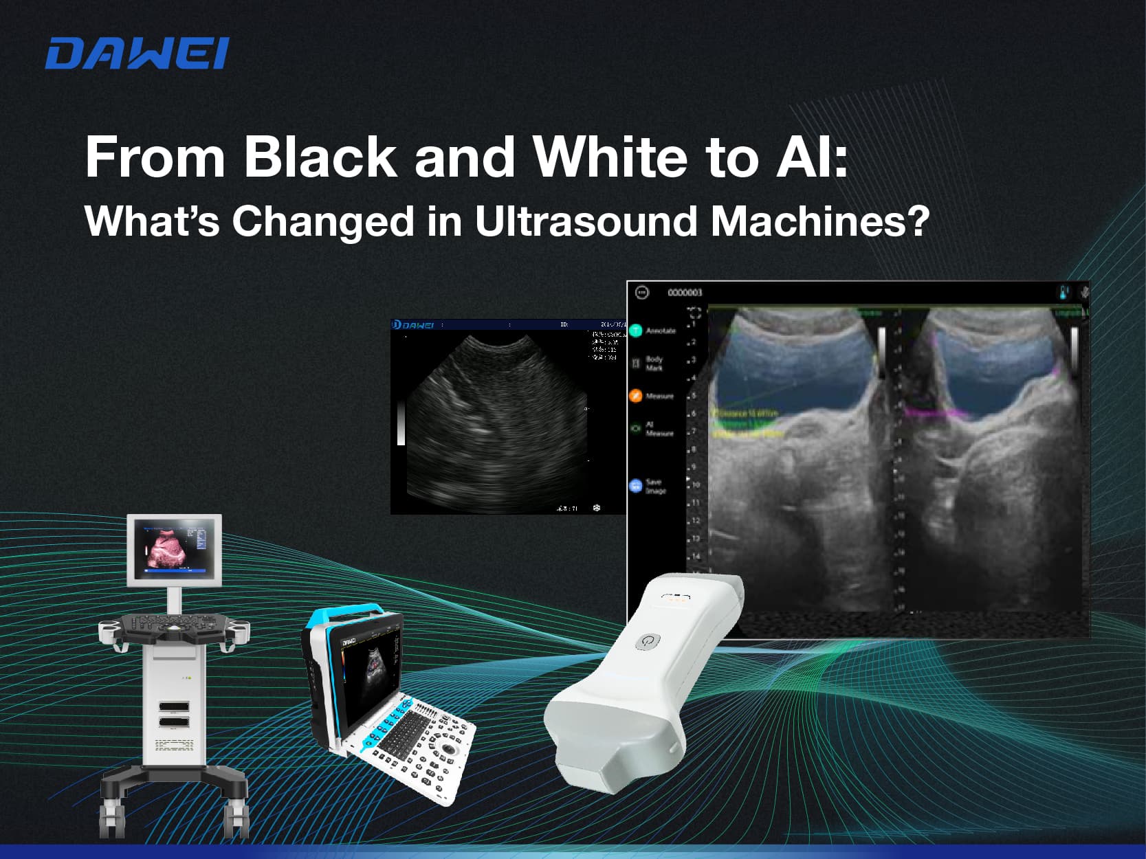 From Black and White to AI What’s Changed in Ultrasound Machines 800 600_画板 1.jpg