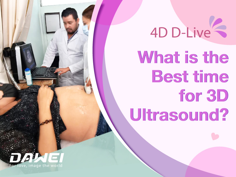 What is the Best time for 3D Ultrasound？-800-600.jpg