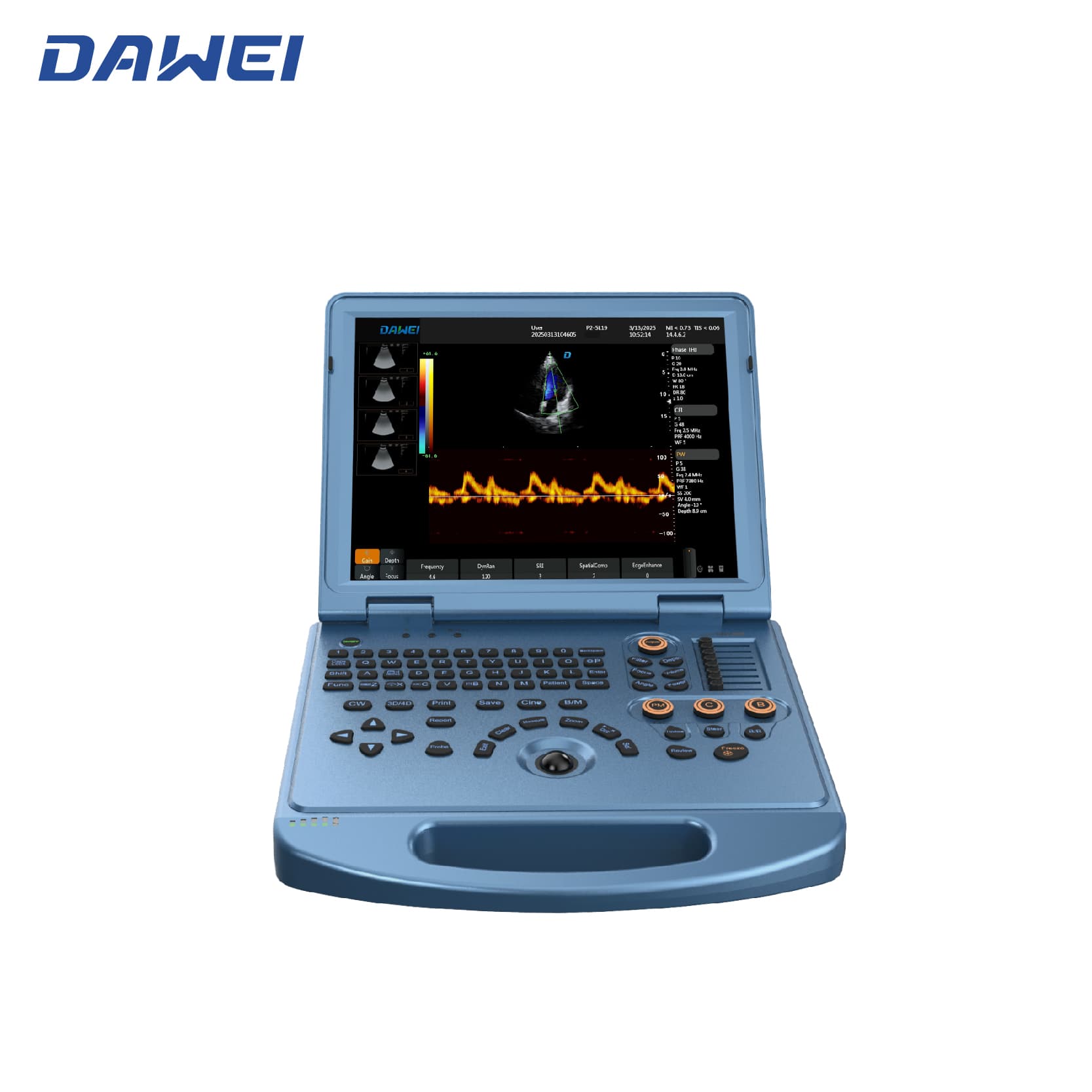 Доступная ультразвуковая система 4D ноутбука