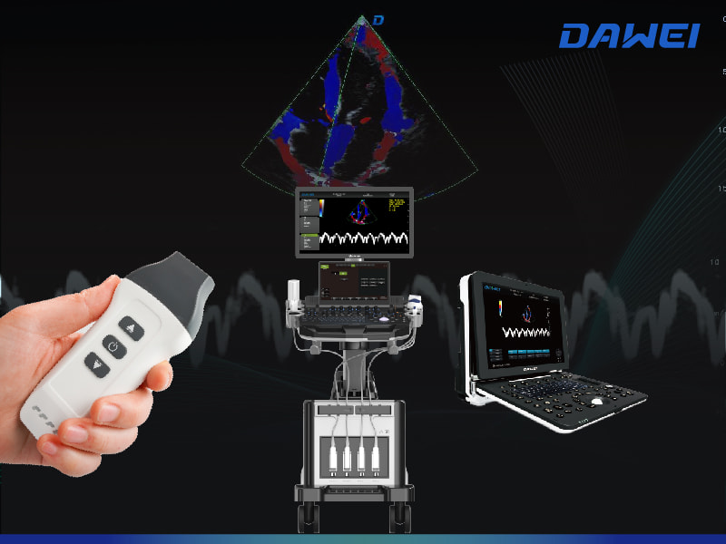 Прорыв в визуализации движения и кровотока