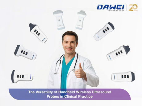 The Versatility of Handheld Wireless Ultrasound Probes in Clinical Practice800 600_画板 1.jpg