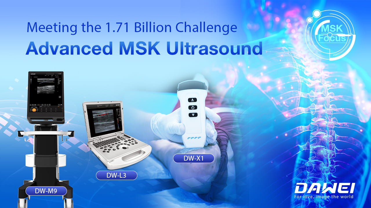 Meeting the 1.71 Billion Challenge Advanced MSK Ultrasound.jpg
