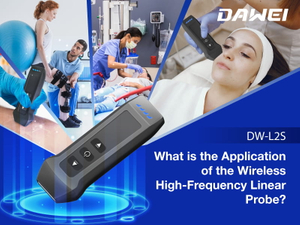 What is the Application of the Wireless High-Frequency Linear Probe800-600.jpg