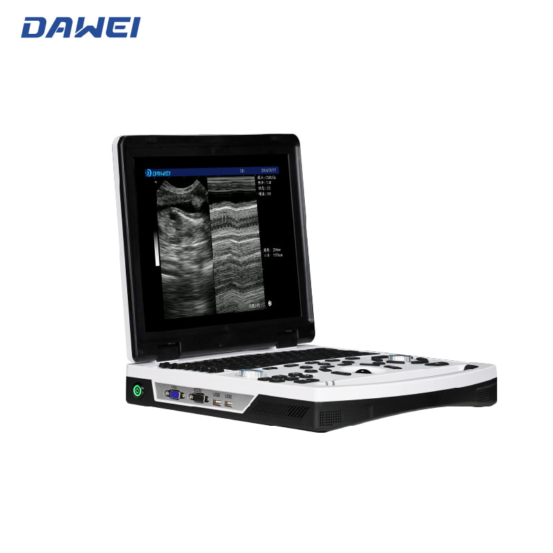 Портативная B/W Ультразвуковая диагностическая система